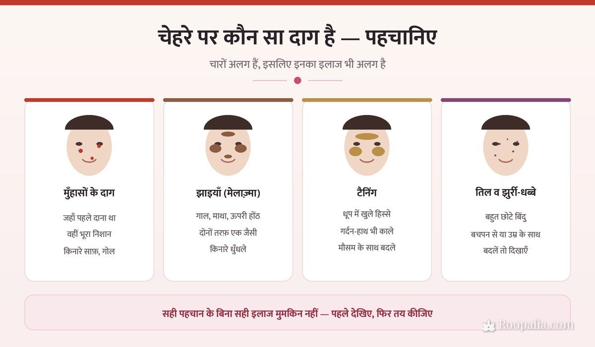 चेहरे पर कौन सा दाग है — मुँहासों के दाग, झाइयाँ मेलाज़्मा, टैनिंग और तिल की पहचान