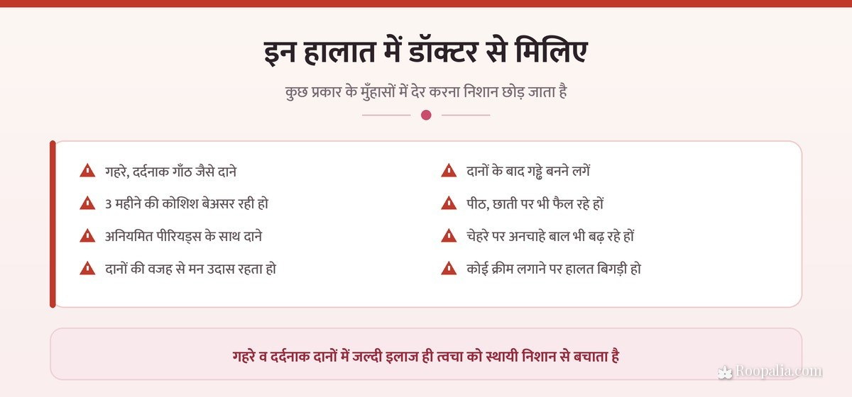 पिंपल्स में डॉक्टर से कब मिलें — आठ चेतावनी संकेत
